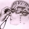 lobotomy ahh